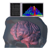 Illustration of brain activity displayed on neurofeedback monitors